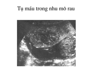 Tô m¸u trong nhu m« rau
 
