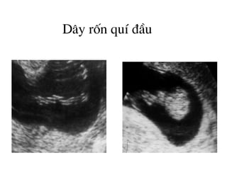 D©y rèn quÝ ®Çu
 