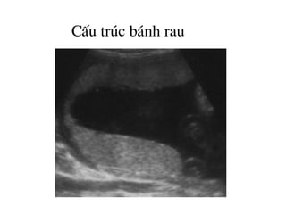 CÊu tróc b¸nh rau
 