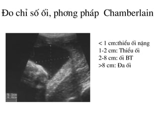 §o chØ sè èi, ph¬ng ph¸p Chamberlain
< 1 cm:thiÓu èi nÆng
1-2 cm: ThiÓu èi
2-8 cm: èi BT
>8 cm: §a èi
 