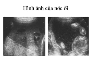 H×nh ¶nh cña níc èi
 