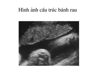 H×nh ¶nh cÊu tróc b¸nh rau
 