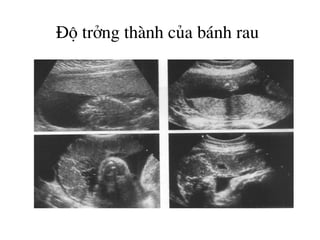 §é trëng thµnh cña b¸nh rau
 