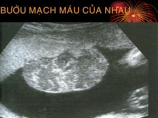 BÖÔÙU MAÏCH MAÙU CUÛA NHAU
 