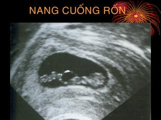 NANG CUOÁNG ROÁN
 