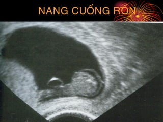 NANG CUOÁNG ROÁN
 