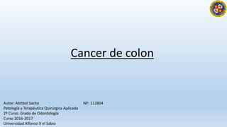 Cancer de colon
Autor: Abitbol Sacha NP: 112804
Patología y Terapéutica Quirúrgica Aplicada
2º Curso. Grado de Odontología
Curso 2016-2017
Universidad Alfonso X el Sabio
 