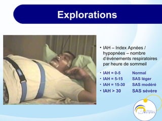 SAS | PPT