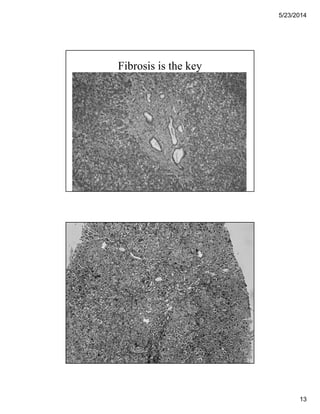 5/23/2014
13
Fibrosis is the key
 