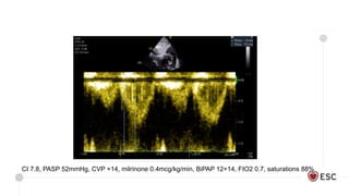 ECHO by the clinician | PPTX