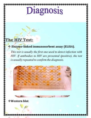 The HIV Test:
 Enzyme-linked immunosorbent assay (ELISA).
This test is usually the first one used to detect infection with
HIV. If antibodies to HIV are presented (positive), the test
is usuallyrepeated to confirm the diagnosis.
Western blot.
 