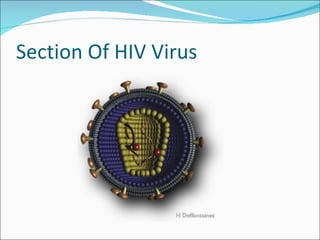 Section Of HIV Virus 