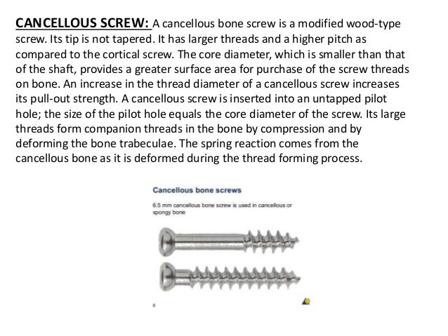 Anatomy of a bone screw, cortical screw vs cancellous screw, wood sc…