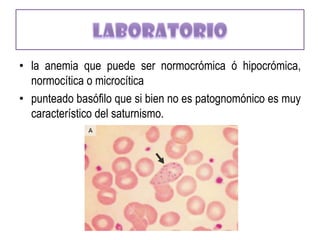 Alteraciones Renales:El plomo lesiona los tubulos renales produciendo aminhoaciduria, glucosuria, fosfaturia, glomerulonefritis e hipertensión
