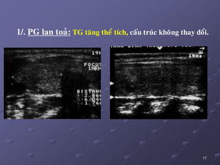 17
1/. PG lan toaû: TG taêng theå tích, caáu truùc khoâng thay ñoåi.
 