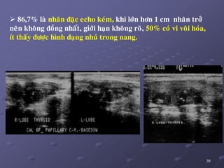 38
 86,7% laø nhaân ñaëc echo keùm, khi lôùn hôn 1 cm nhaân trôû
neân khoâng ñoàng nhaát, giôùi haïn khoâng roõ, 50% coù vi voâi hoùa,
ít thaáy ñöôïc hình daïng nhuù trong nang.
 