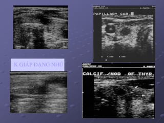 42
K GIAÙP DAÏNG NHUÙ
 