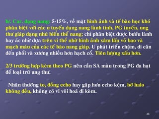 46
b/. Car. daïng nang: 5-15%, veà maët hình aûnh vaø teá baøo hoïc khoù
phaân bieät vôùi caùc u tuyeán daïng nang laønh tính, PG tuyeán, ung
thö giaùp daïng nhuù bieán theå nang; chæ phaân bieät ñöôïc böôùu laønh
hay aùc nhôø döïa treân vi theå nhôø hình aûnh xaâm laán voû bao vaø
maïch maùu cuûa caùc teá baøo nang giaùp. U phaùt trieån chaäm, di caên
ñeán phoåi vaø xöông nhieàu hôn haïch coå. Tieân löôïng xaáu hôn.
2/3 tröôøng hôïp keøm theo PG neân caàn SA maøu trong PG ña haït
ñeå loaïi tröø ung thö.
Nhaân thöôøng to, ñoàng echo hay gaëp hôn echo keùm, bôø halo
khoâng ñeàu, khoâng coù vi voâi hoaù ñi keøm.
 