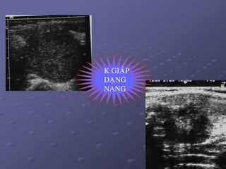 49
K GIAÙP
DAÏNG
NANG
 