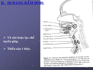 80
 Voâ saûn hoaëc laïc choå
tuyeán giaùp.
 Thieåu saûn 1 thuøy.
II. DÒ DAÏNG BAÅM SINH:
 