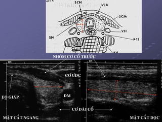 9
EO GIAÙP
CÔ ÖÑC
ÑM
CÔ DAØI COÅ
NHOÙM CÔ COÅ TRÖÔÙC
MAËT CAÉT NGANG MAËT CAÉT DOÏC
 