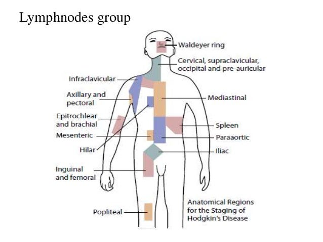 Hodgkin’s lymphoma
