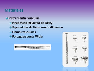 Materiales
Instrumental Vascular
Pinza mano izquierda de Bakey
Separadores de Desmarres o Gilbernau
Clamps vasculares
Portagujas punta Widia

 
