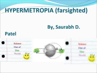 HYPERMETROPIA (farsighted)

             By, Saurabh D.
Patel
 