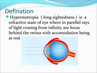 Defination
Hypermetropia ( long sightedness ) is a
 refractive state of eye where in parellel rays
 of light coming from infinity are focus
 behind the retina with accomodation being
 at rest
 