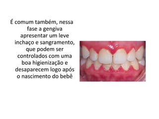 É comum também, nessa fase a gengiva apresentar um leve inchaço e sangramento, que podem ser controlados com uma boa higienização e desaparecem logo após o nascimento do bebê 