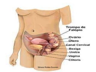 Silmara Robles Escorsin 