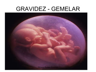 GRAVIDEZ - GEMELAR Silmara Robles Escorsin 