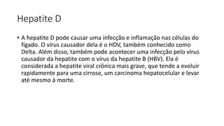 Hepatite D
• A hepatite D pode causar uma infecção e inflamação nas células do
fígado. O vírus causador dela é o HDV, também conhecido como
Delta. Além disso, também pode acontecer uma infecção pelo vírus
causador da hepatite com o vírus da hepatite B (HBV). Ela é
considerada a hepatite viral crônica mais grave, que tende a evoluir
rapidamente para uma cirrose, um carcinoma hepatocelular e levar
até mesmo á morte.
 
