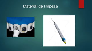 Material de limpeza
 