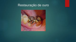 Restauração de ouro
 