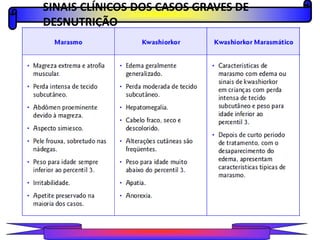SINAIS CLÍNICOS DOS CASOS GRAVES DE
DESNUTRIÇÃO
PROFESSORALEXANDRE
 