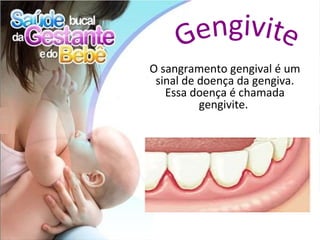 O sangramento gengival é um
 sinal de doença da gengiva.
   Essa doença é chamada
          gengivite.
 