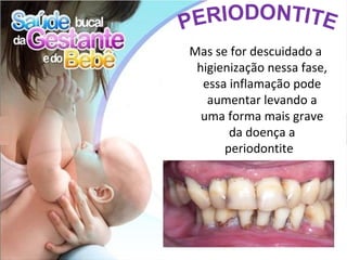 Mas se for descuidado a
 higienização nessa fase,
  essa inflamação pode
   aumentar levando a
  uma forma mais grave
       da doença a
      periodontite
 