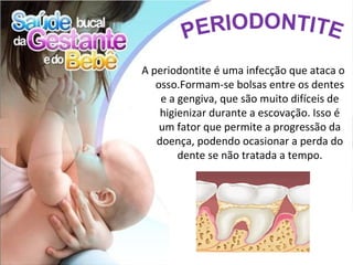 A periodontite é uma infecção que ataca o
   osso.Formam-se bolsas entre os dentes
    e a gengiva, que são muito difíceis de
    higienizar durante a escovação. Isso é
    um fator que permite a progressão da
   doença, podendo ocasionar a perda do
        dente se não tratada a tempo.
 