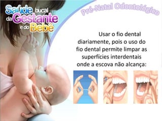 Usar o fio dental
 diariamente, pois o uso do
fio dental permite limpar as
   superfícies interdentais
onde a escova não alcança:
 