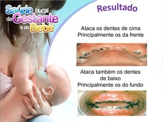 Ataca os dentes de cima
Principalmente os da frente




 Ataca também os dentes
         de baixo
Principalmente os do fundo
 