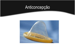 Anticoncepção
 