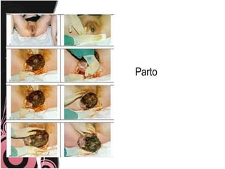 Parto
 