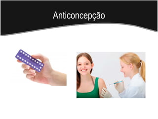 Anticoncepção
 