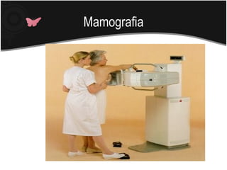 Mamografia
 