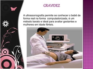 A ultrassonografia permite se conhecer o bebê de
forma real na forma computadorizada, é um
método barato e ideal para avaliar gestantes e
mulheres em idade férteis.
 