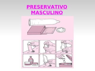 PRESERVATIVO
 MASCULINO
 
