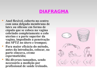 DIAFRAGMA

    Anel flexível, coberto no centro
    com uma delgada membrana de
    latex ou silicone em forma de
    cúpula que se coloca na vagina
    cobrindo completamente o colo
    uterino e a parte superior da
    vagina, impedindo a penetração
    dos SPTZ no útero e trompas;

    Para maior eficácia do método,
    antes da introdução, colocar, na
    parte côncava, creme
    espermaticida;

    Há diversos tamanhos, sendo
    necessário a medição por
    profissional de saúde treinado.
 