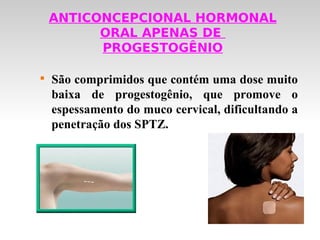 ANTICONCEPCIONAL HORMONAL
          ORAL APENAS DE
          PROGESTOGÊNIO


    São comprimidos que contém uma dose muito
    baixa de progestogênio, que promove o
    espessamento do muco cervical, dificultando a
    penetração dos SPTZ.
 