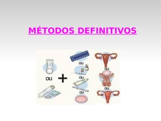 MÉTODOS DEFINITIVOS
 